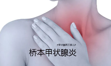 桥本氏甲状腺炎,具体,都有,哪些,疾病症状,