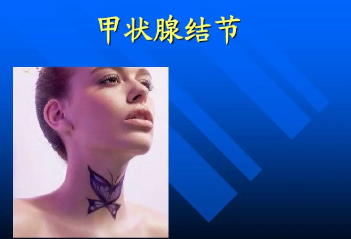 甲状腺结节患者,需要,了解,的,疾病常识,